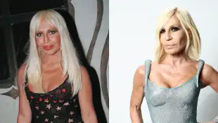Donatella Versace früher vs. heute