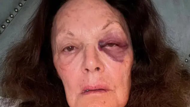 Diane von Fürstenberg