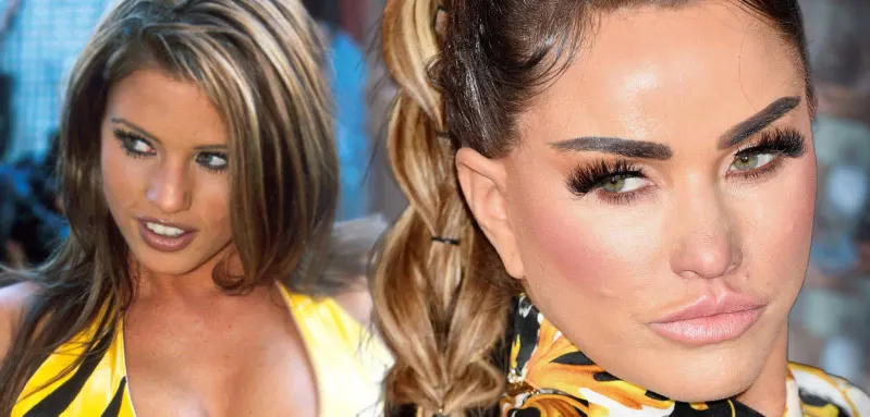 Die Transformation von Katie Price