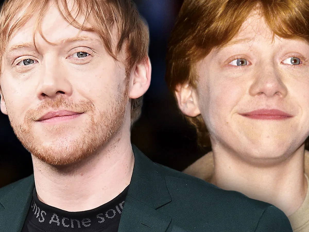 Ron Weasley Vorher Und Nachher(03)