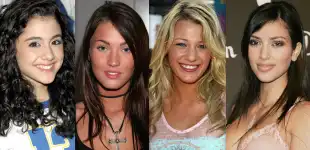 Zu viele Beauty-OPs: Diese Promi-Bilder werden wir so nie wieder sehen