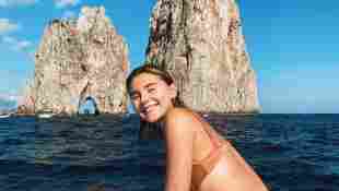 Stefanie Giesinger mit Mini-Makel: Sie zeigt ihre Cellulitis