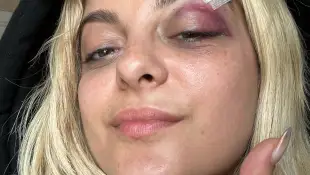 Bebe Rexha nach Handy-Attacke