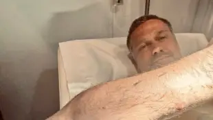 Wayne Carpendale nach Insektenstich