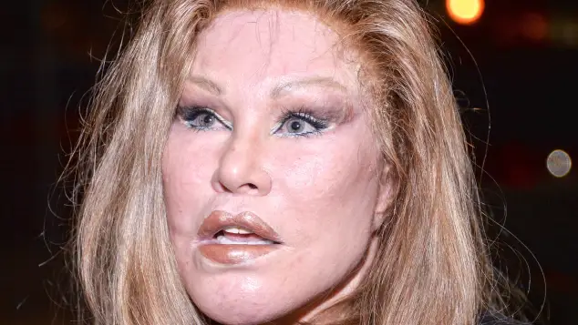 Jocelyn Wildenstein