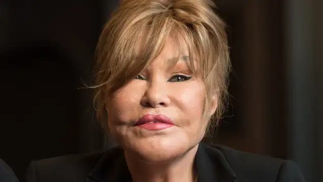Jocelyn Wildenstein