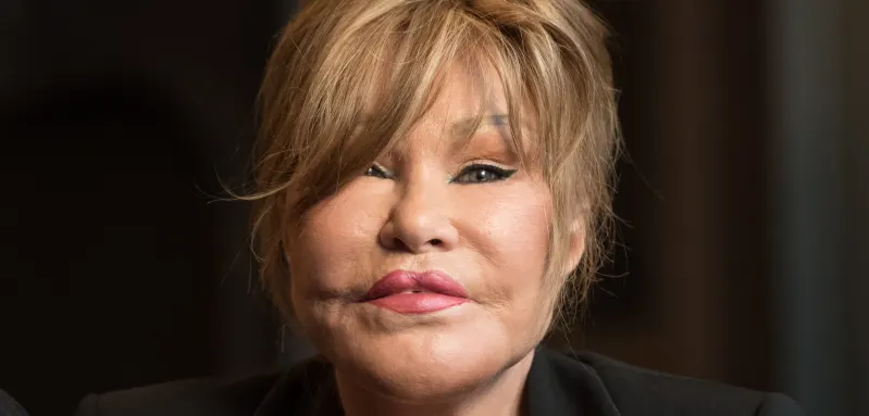 Jocelyn Wildenstein