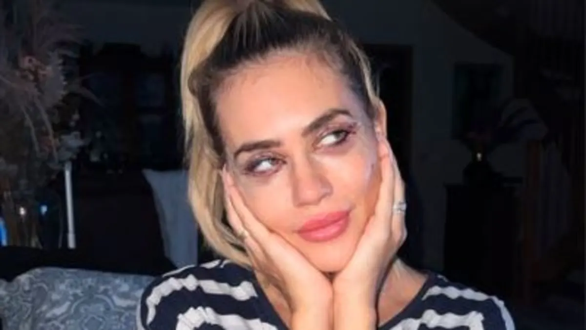 Jessica Haller nach einer Beauty-OP