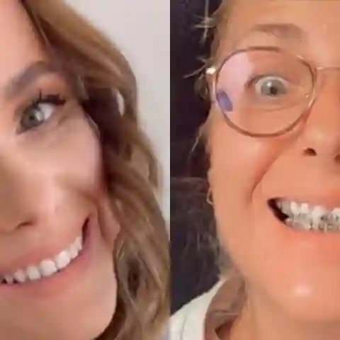 Anna Heiser trug lange eine Zahnspange