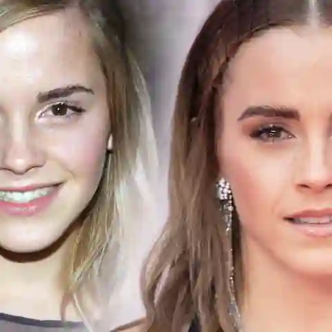 Die krasse Verwandlung von Emma Watson