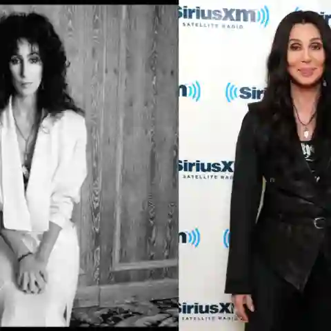 Cher lies sich schon öfter Botox spritzen