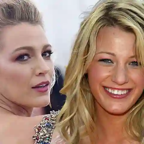 Blake Lively behauptet, bisher keine Beauty-OP gemacht zu haben