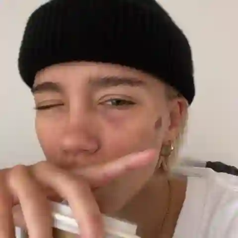 lena mantler verletzt