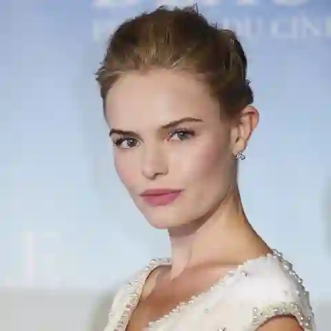 Promis mit seltsamen Körperteilen, Kate Bosworth, Promis mit Schönheitsmakel