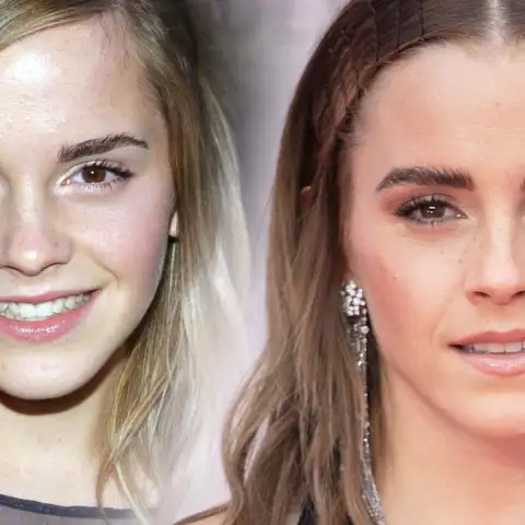 Die krasse Verwandlung von Emma Watson