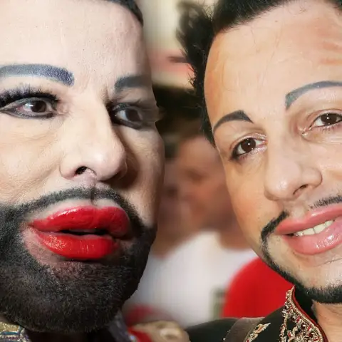 Harald Glööckler früher und heute