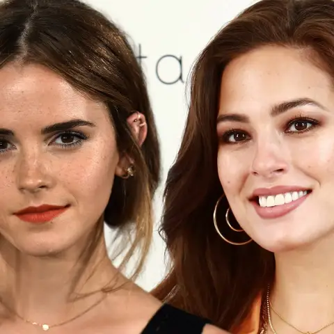 Stars, von denen du nicht wusstest, dass sie Sommersprossen haben