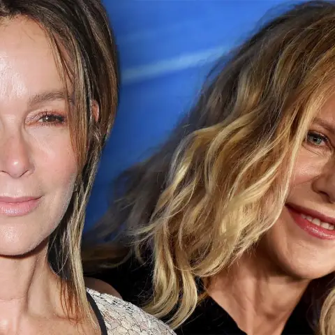 Stars, die ihr Äußeres durch Beauty-OPs zerstört haben