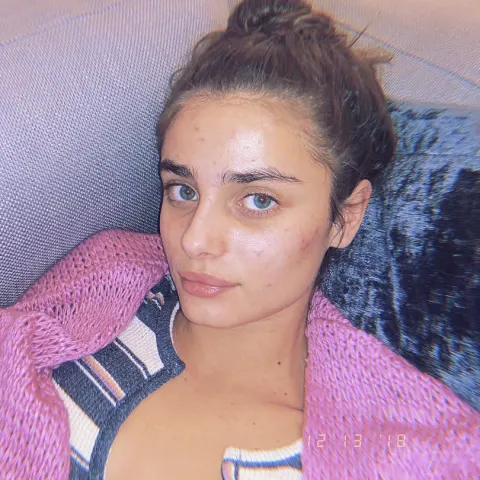 Taylor Hill ohne Make-up