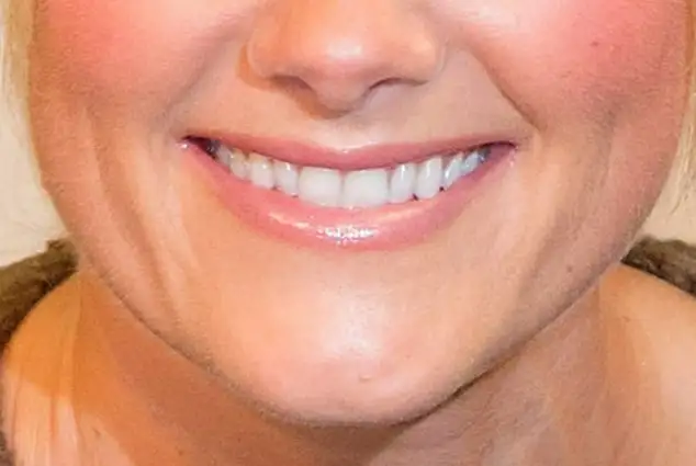 helene fischer