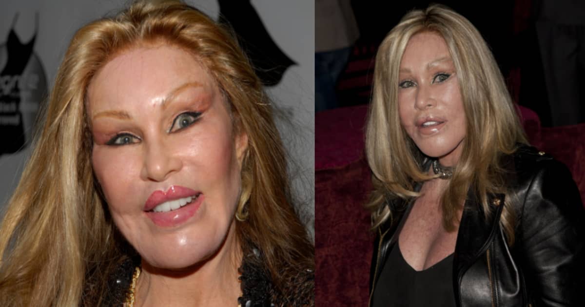 die schlimmsten botox gesichter