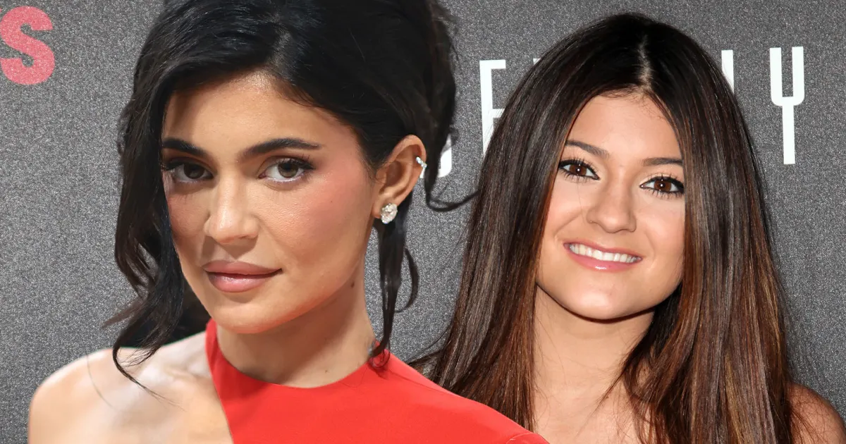 Mega Star Kylie Jenner: The Beauty Transformation and Regrets