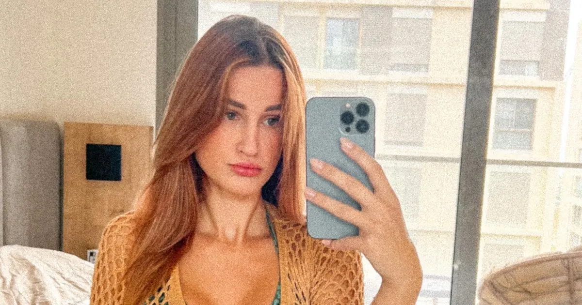 Nach Beauty-OPs: GNTM-Neele völlig verändert