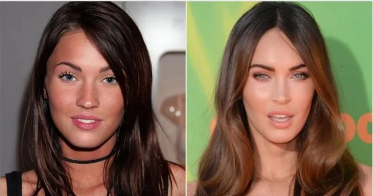 Pamela Anderson vorher und nachher