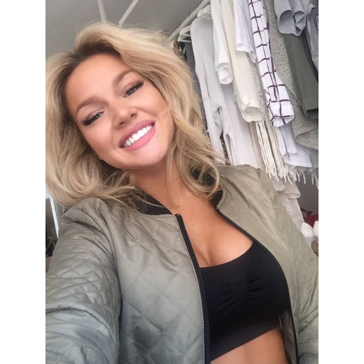Shirin David Sie hat sich ihre Zähne selbst abgefeilt