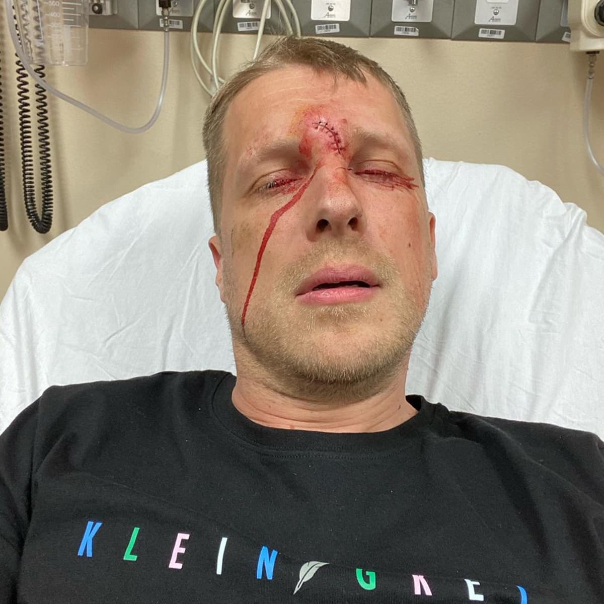Oliver Pocher im Krankenhaus nach Verletzung mit Gewehr