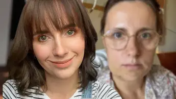 Anna Heiser zeigt verändertes Gesicht nacht OP