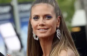 Heidi Klum hat sich im Urlaub verletzt