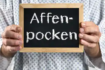 mpox virus affenpocken