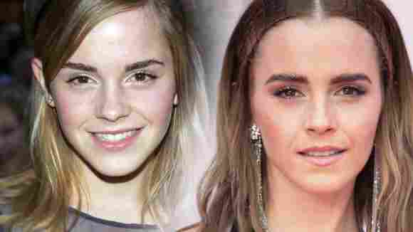 Die krasse Verwandlung von Emma Watson