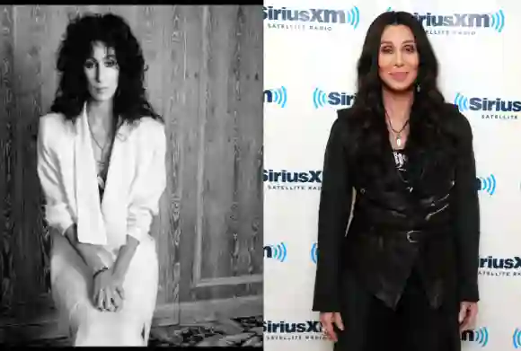 Cher lies sich schon öfter Botox spritzen