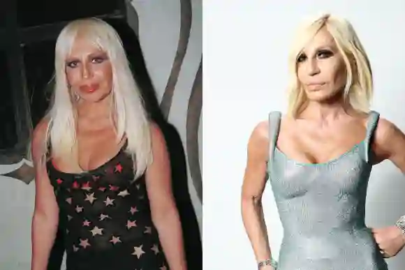 Donatella Versace früher vs. heute