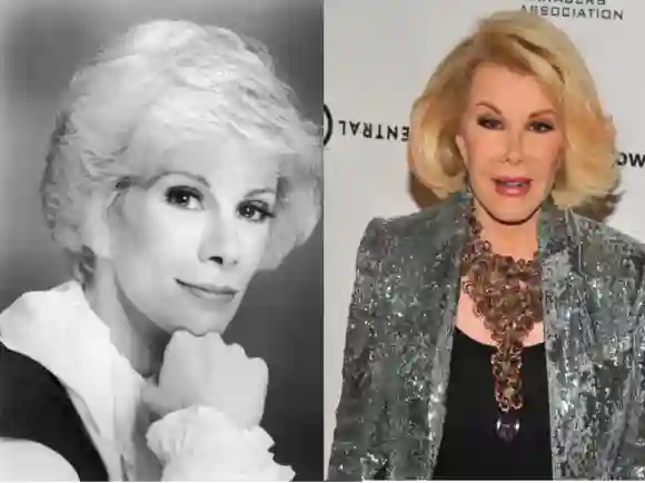 Joan Rivers lies sich nicht nur Botox spritzen