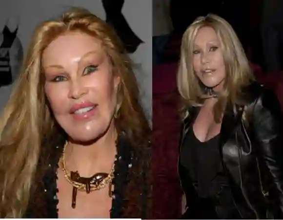 Jocelyn Wildenstein wurde durch ihr Äußeres bekannt