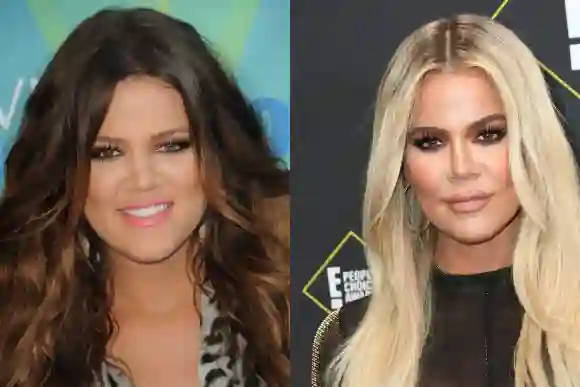 Khloé Kardashian früher vs. heute