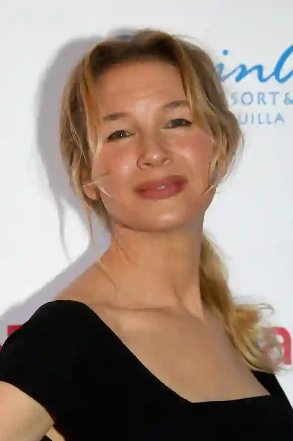 Bei Renée Zellweger hat der Beauty-Doc nachgeholfen