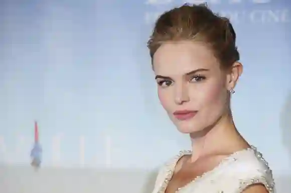 Promis mit seltsamen Körperteilen, Kate Bosworth, Promis mit Schönheitsmakel