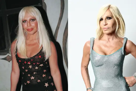 Donatella Versace früher vs. heute