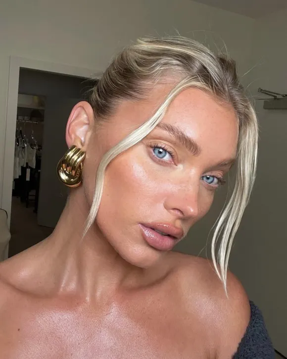 Elsa Hosk zeigt ihre Sommersprossen