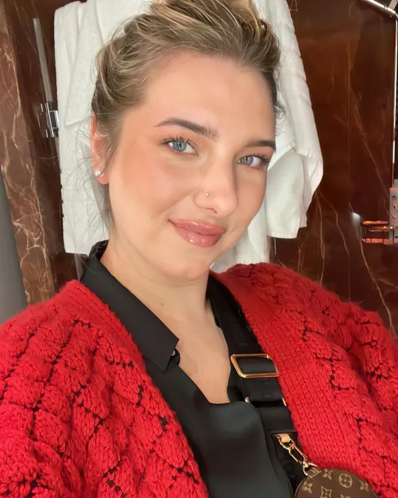 Joelina Karabas Brustverkleinerung